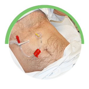 Feeding Tube Medication Support